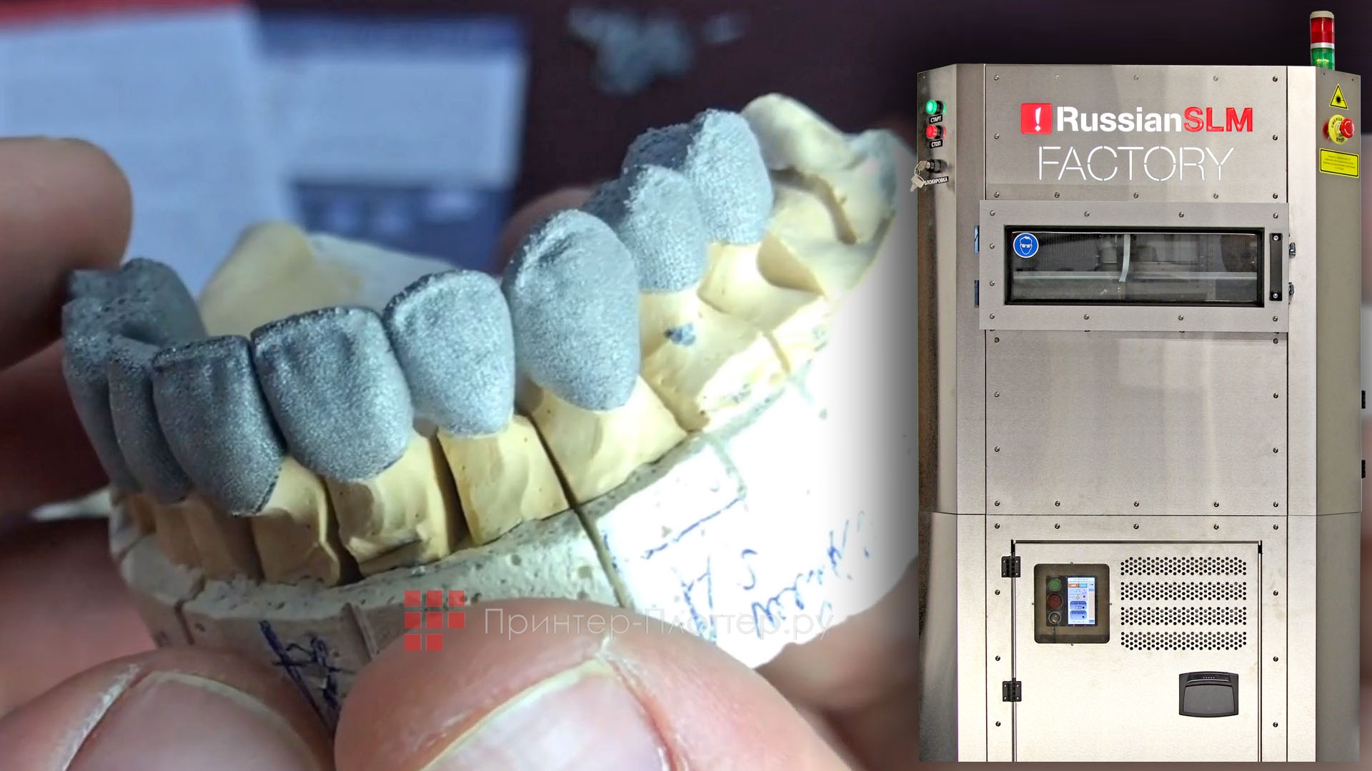 3DSLA RussianSLM FACTORY. Создание индивидуальных имплантов