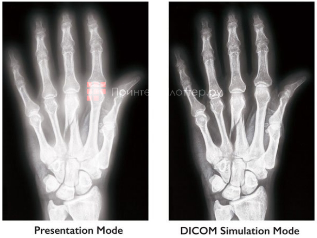 BenQ LU951. Изображения стандарта DICOM