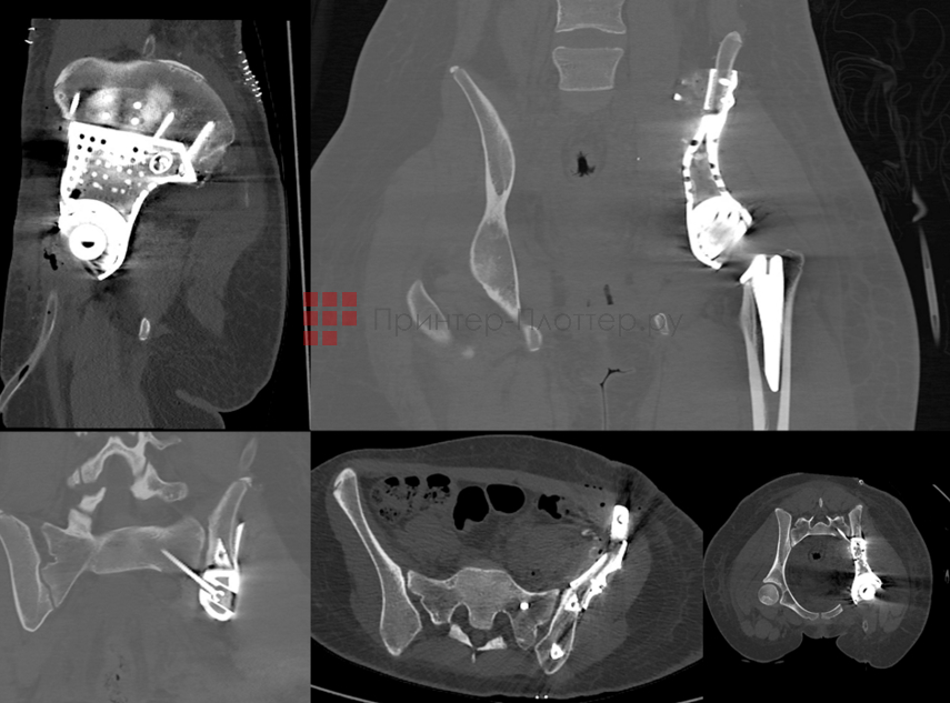 Concept Laser M Line Factory. Медицина