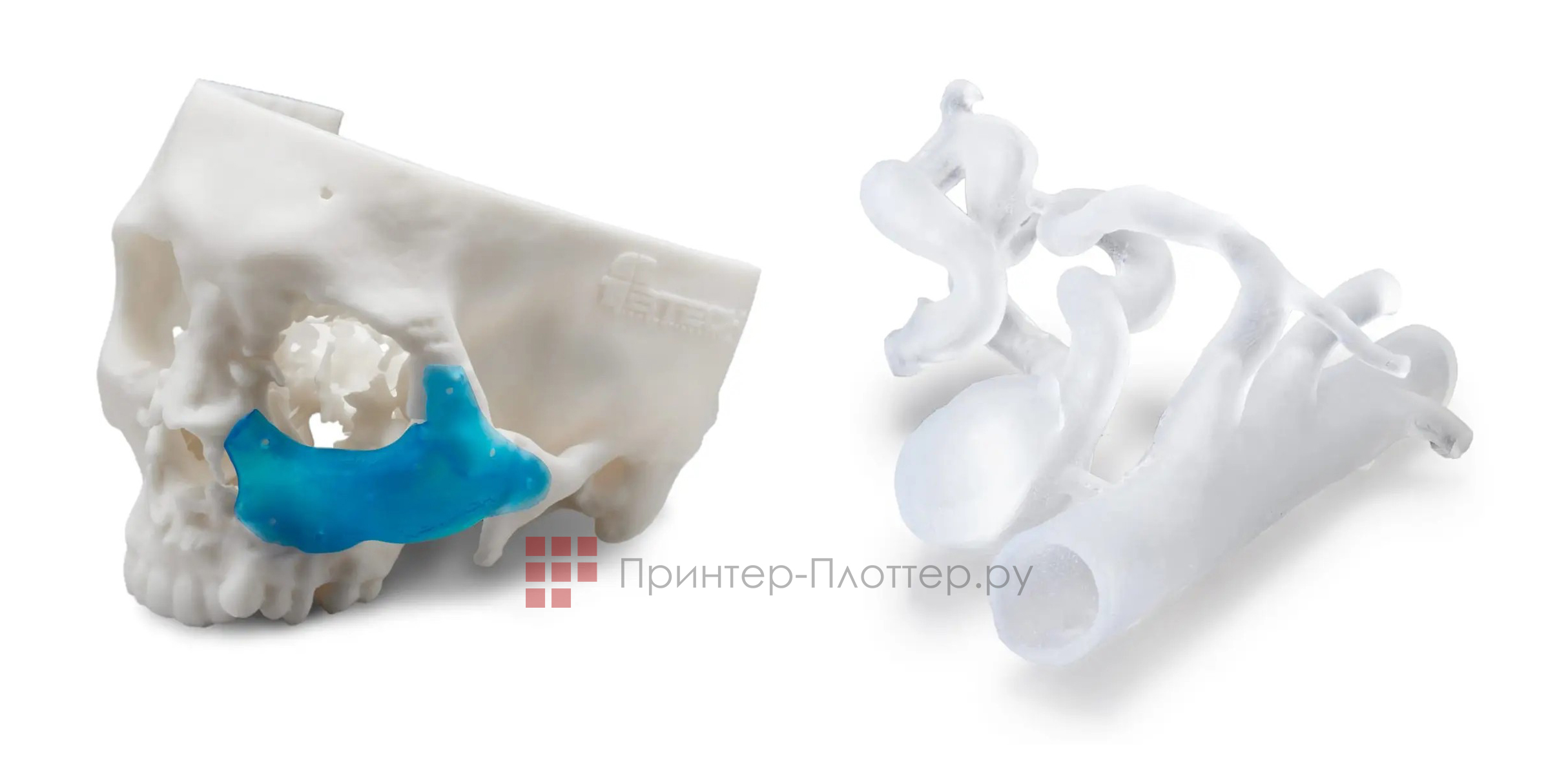 Formlabs Form 3B. Череп и селезеночная артерия