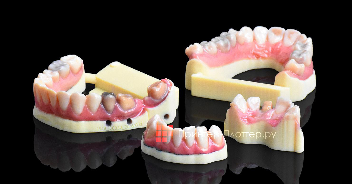 Stratasys J720 Dental. Изделия, создаваемые Stratasys J720 Dental